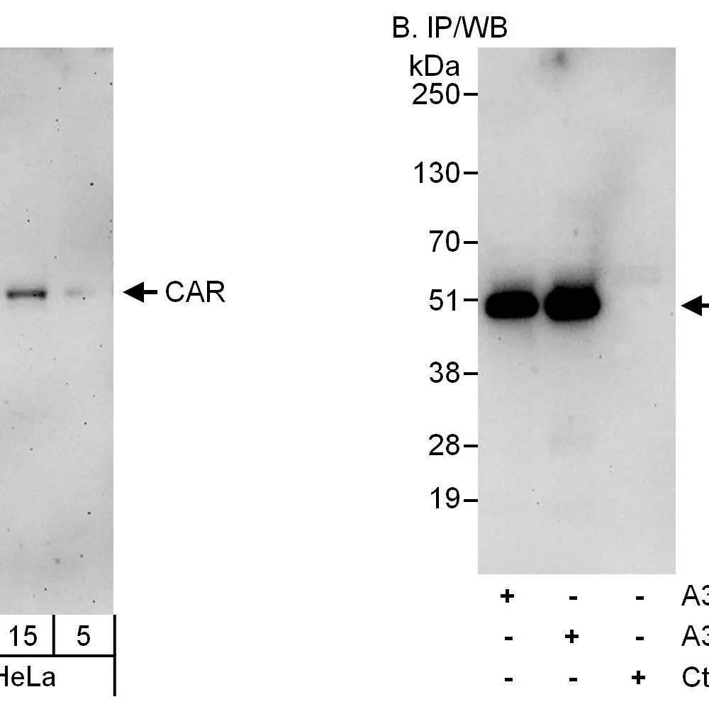 Rabbit anti-CAR Antibody, Affinity Purified