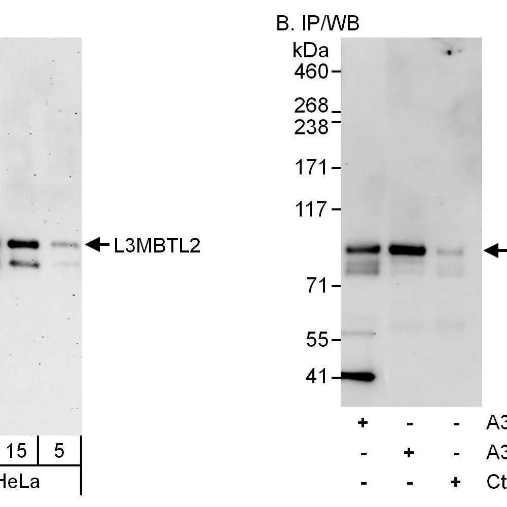 Rabbit anti-L3MBTL2 Antibody, Affinity Purified