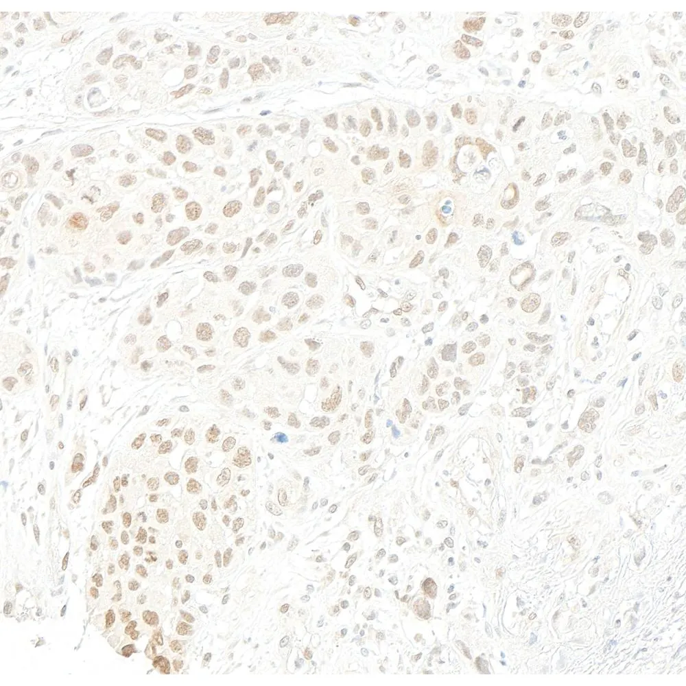 Rabbit anti-RNF2 Antibody, Affinity Purified