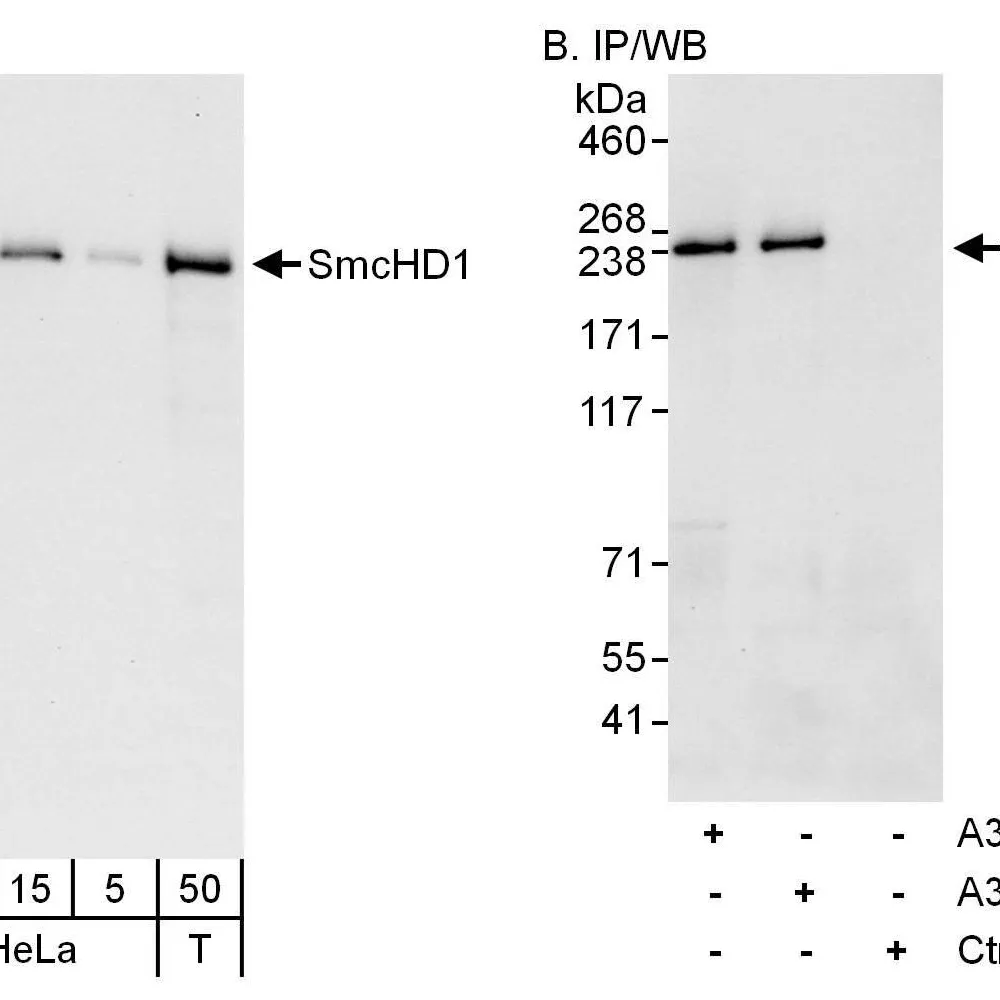Rabbit anti-SmcHD1 Antibody, Affinity Purified