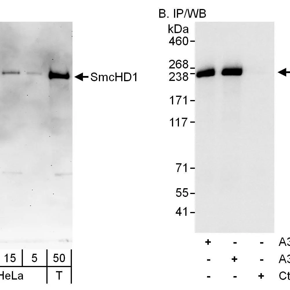 Rabbit anti-SmcHD1 Antibody, Affinity Purified