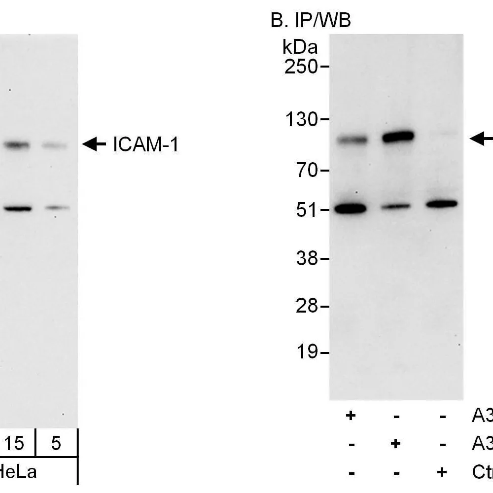Rabbit anti-ICAM-1 Antibody, Affinity Purified