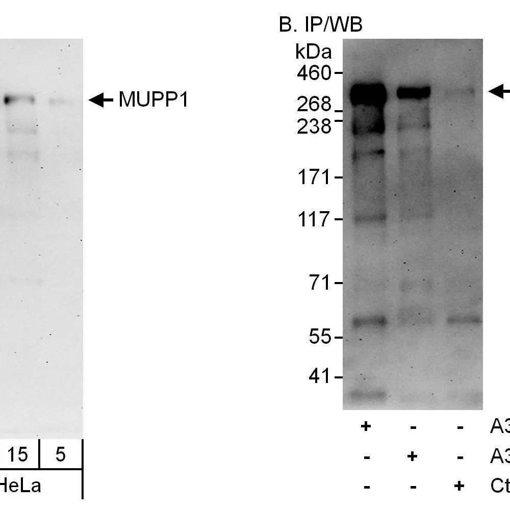 Rabbit anti-MUPP1 Antibody, Affinity Purified