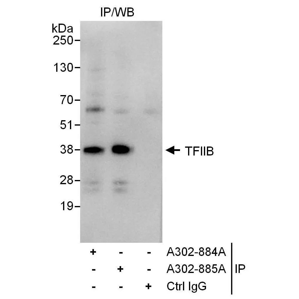 Rabbit anti-GTF2B/TFIIB Antibody, Affinity Purified