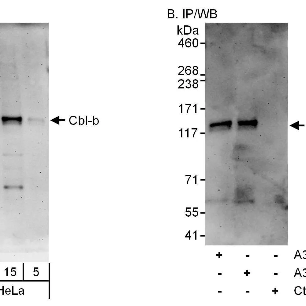 Rabbit anti-Cbl-b Antibody, Affinity Purified