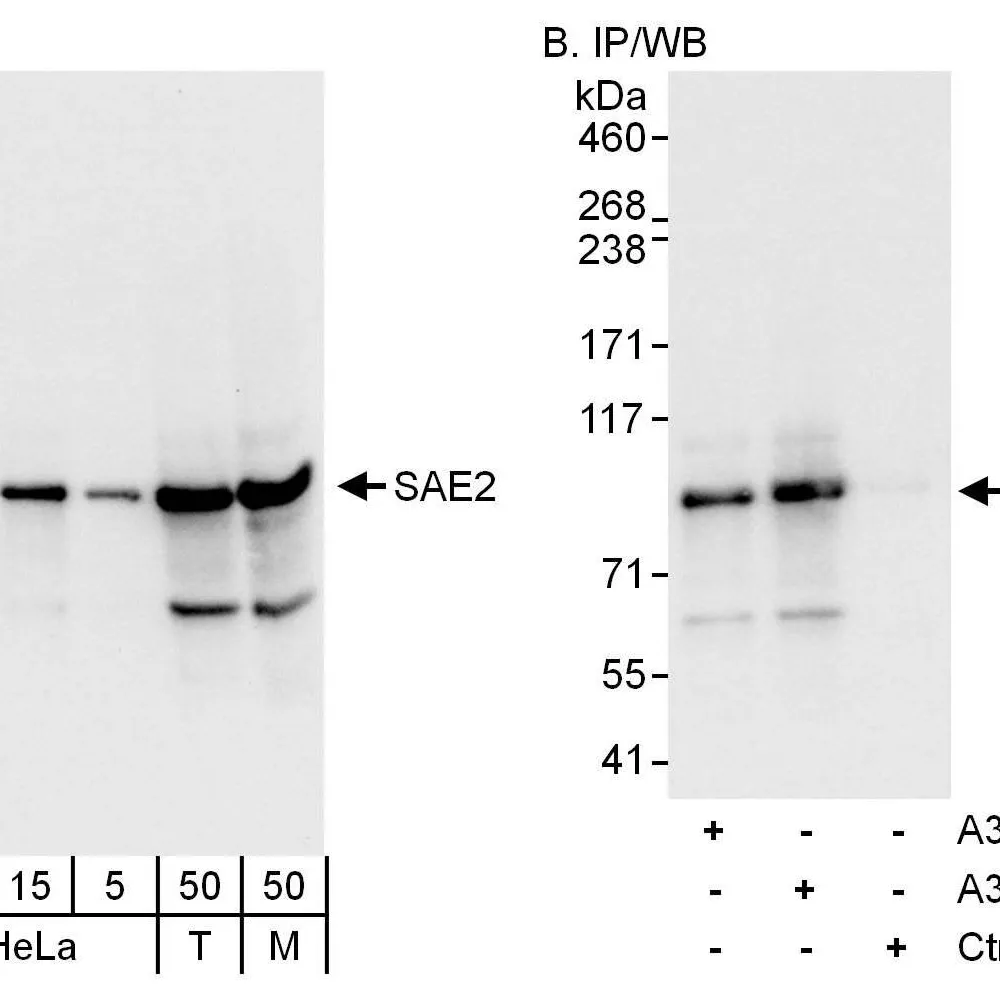 Rabbit anti-SAE2 Antibody, Affinity Purified