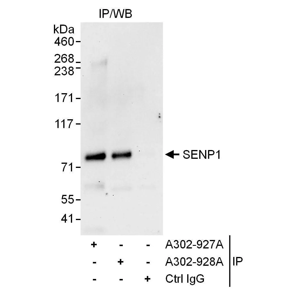 Rabbit anti-SENP1 Antibody, Affinity Purified