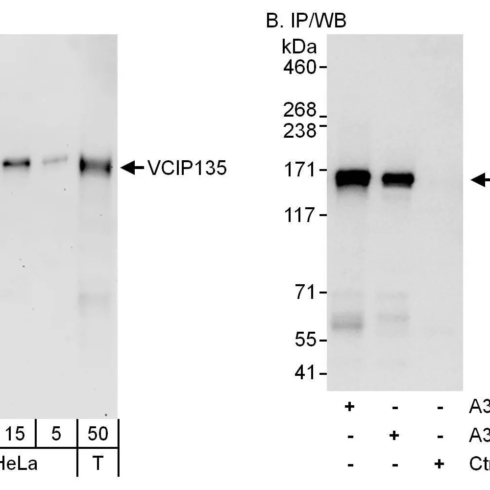 Rabbit anti-VCIP135 Antibody, Affinity Purified