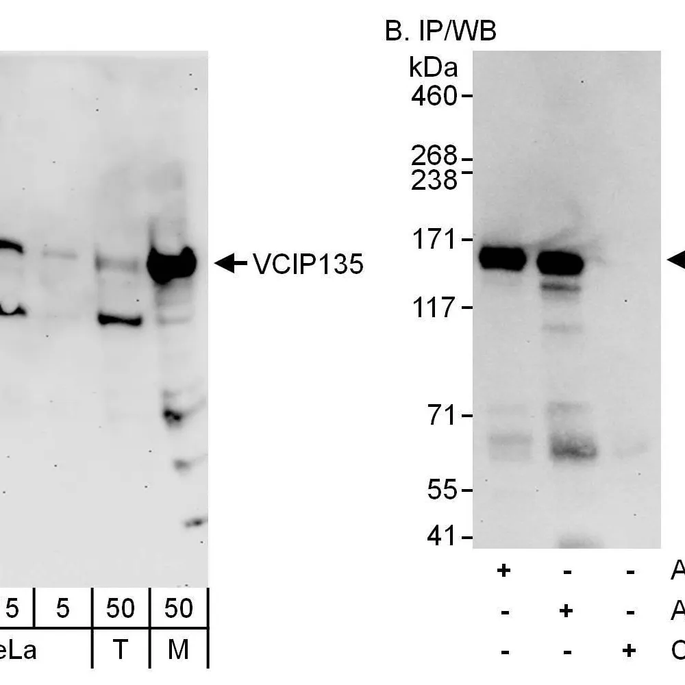 Rabbit anti-VCIP135 Antibody, Affinity Purified