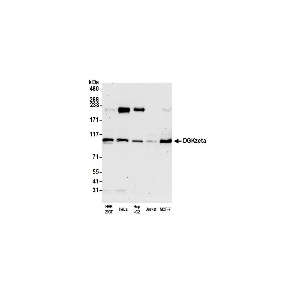 Rabbit anti-DGKzeta Antibody, Affinity Purified