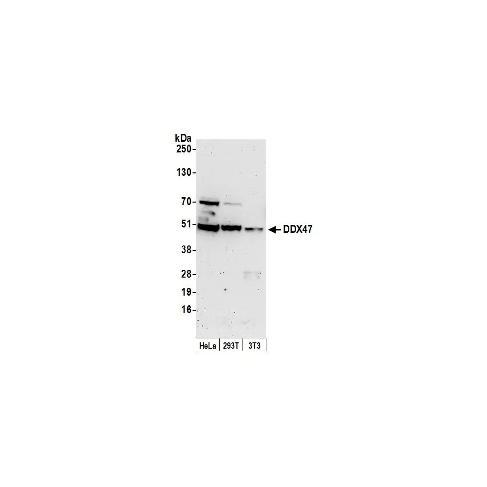 Rabbit anti-DDX47 Antibody, Affinity Purified