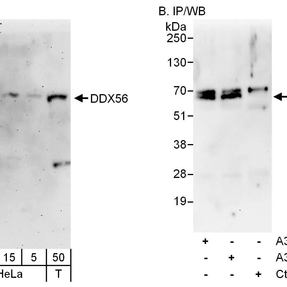 Rabbit anti-DDX56 Antibody, Affinity Purified