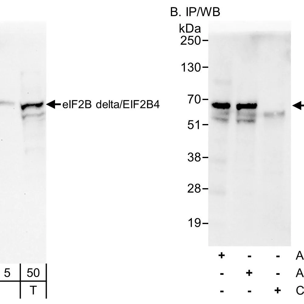 Rabbit anti-eIF2B delta/EIF2B4 Antibody, Affinity Purified