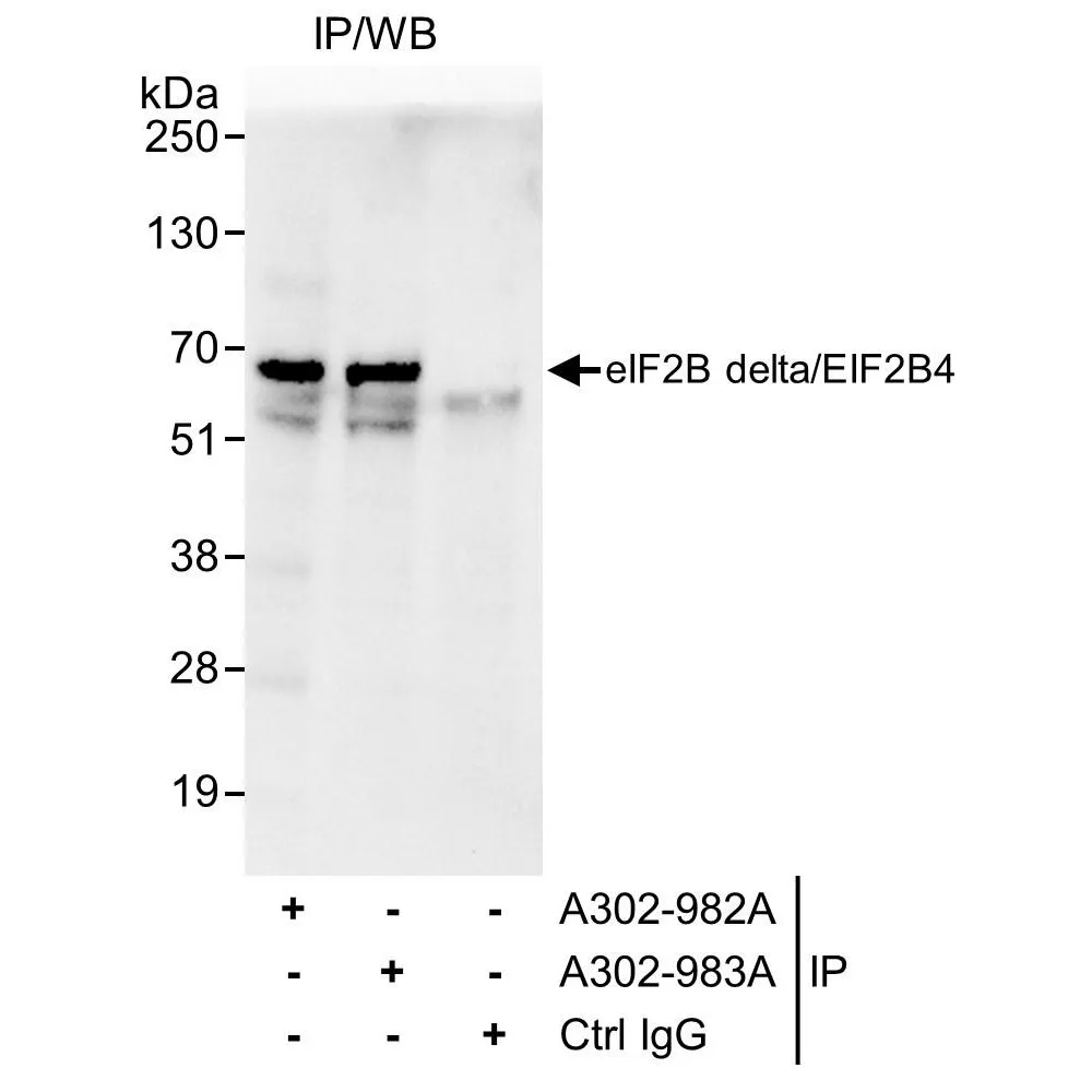 Rabbit anti-eIF2B delta/EIF2B4 Antibody, Affinity Purified