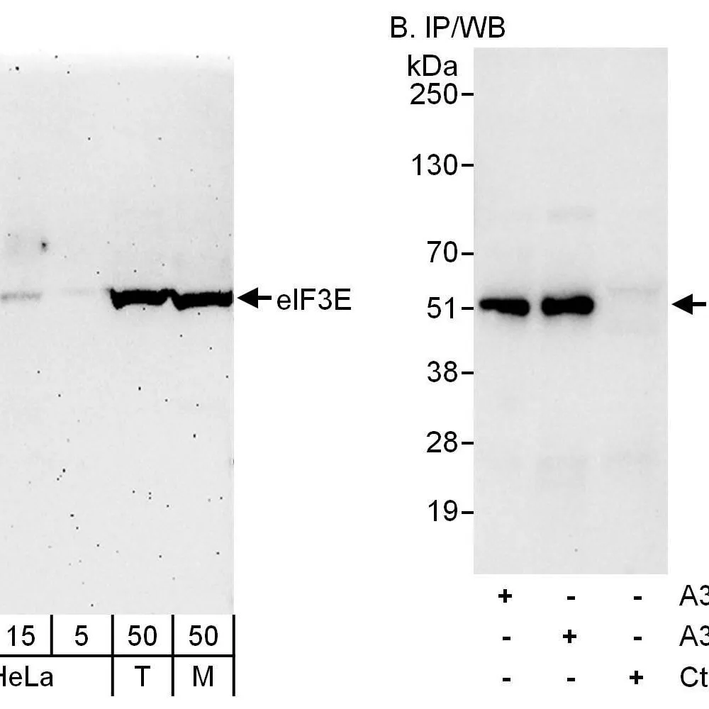 Rabbit anti-eIF3E Antibody, Affinity Purified