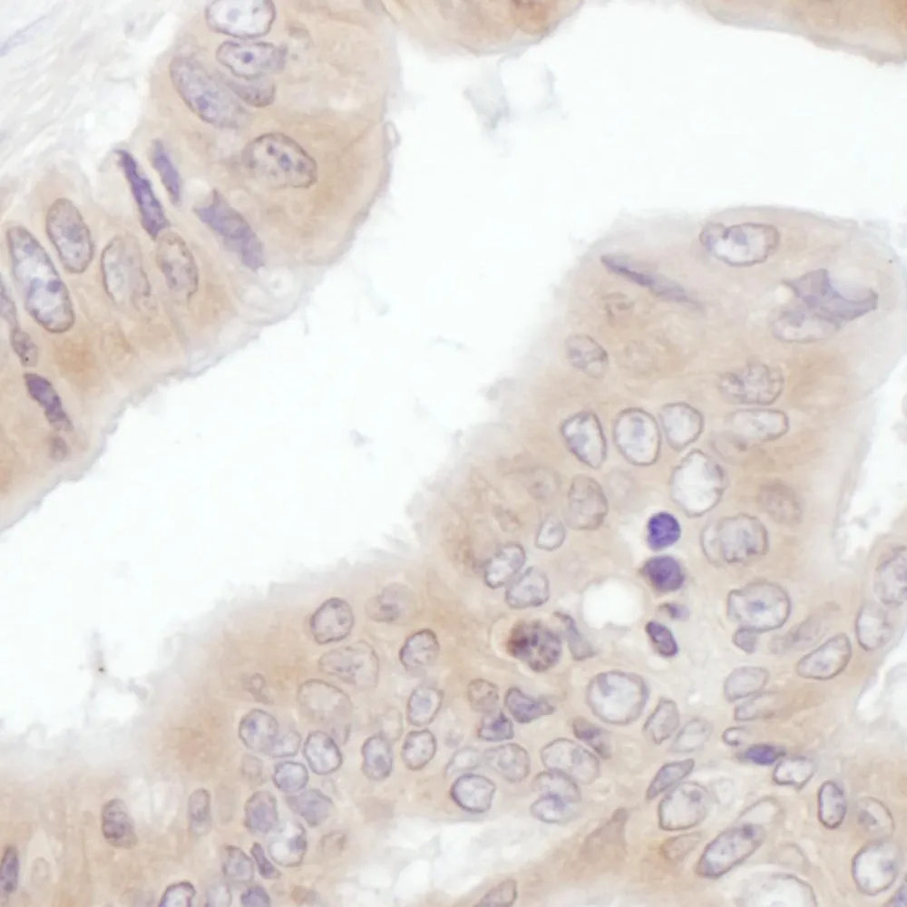 Rabbit anti-eIF3E Antibody, Affinity Purified