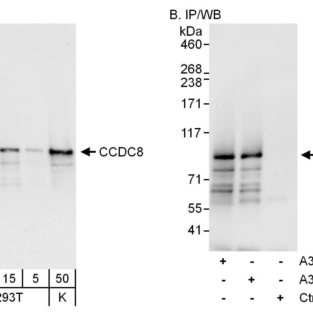 Rabbit anti-CCDC8 Antibody, Affinity Purified