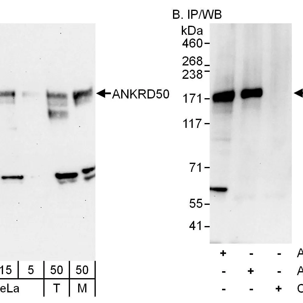 Rabbit anti-ANKRD50 Antibody, Affinity Purified