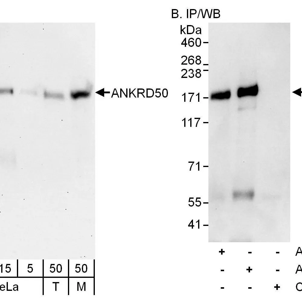 Rabbit anti-ANKRD50 Antibody, Affinity Purified