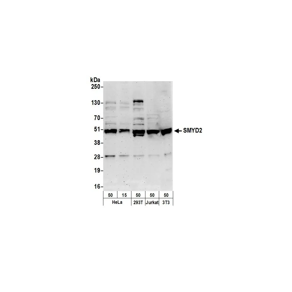 Rabbit anti-SMYD2 Antibody, Affinity Purified