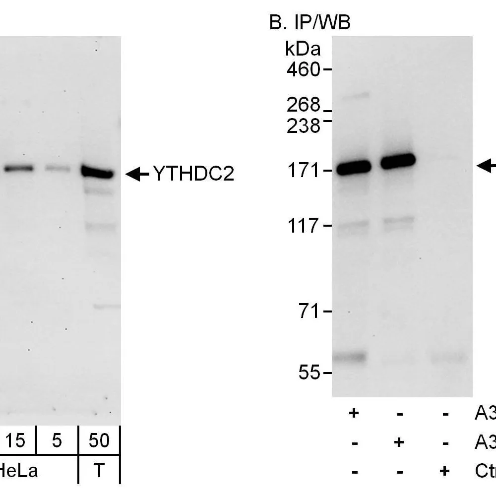 Rabbit anti-YTHDC2 Antibody, Affinity Purified