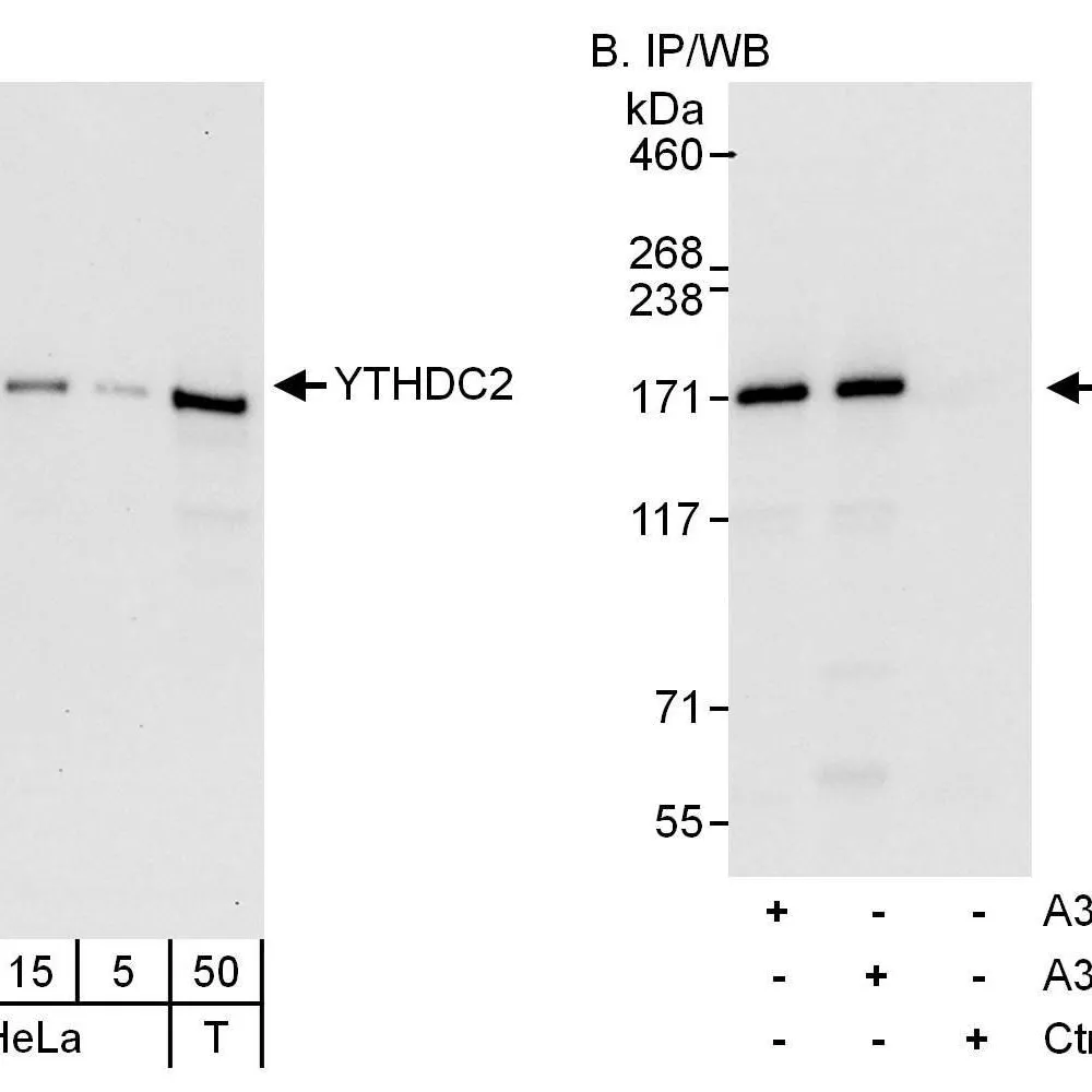 Rabbit anti-YTHDC2 Antibody, Affinity Purified