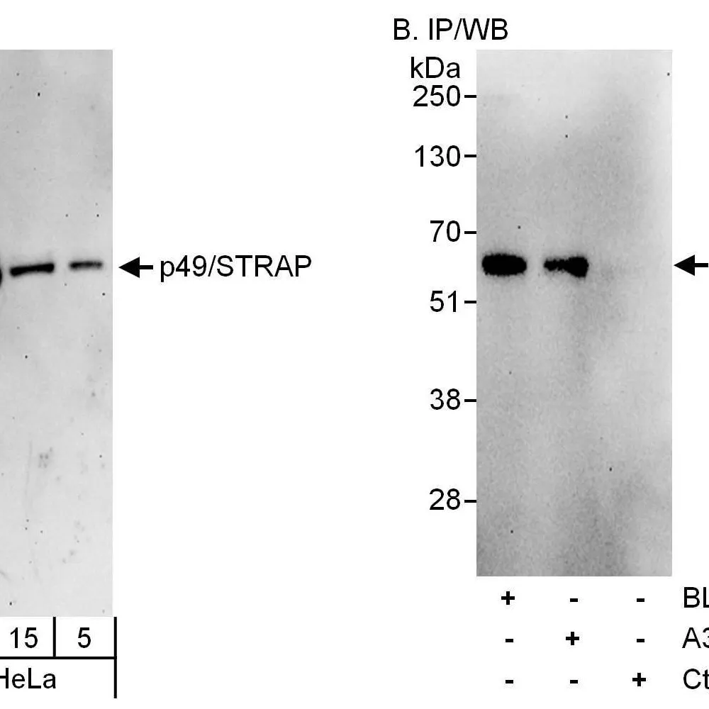 Rabbit anti-p49/STRAP Antibody, Affinity Purified