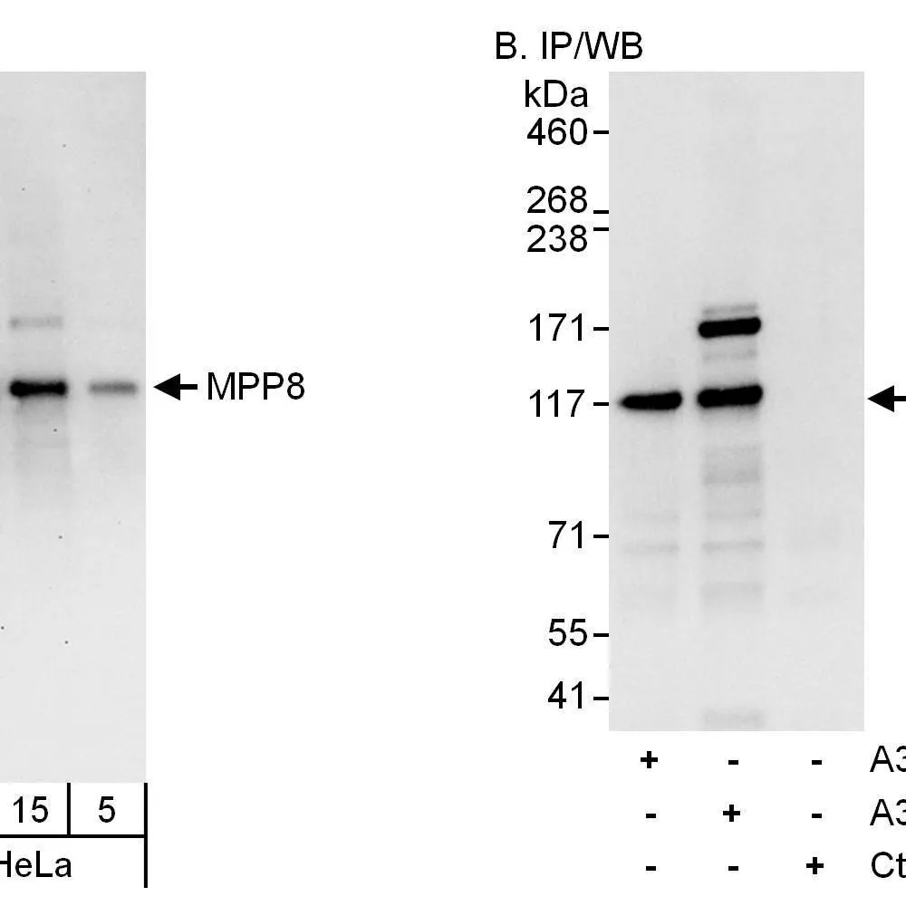 Rabbit anti-MPP8 Antibody, Affinity Purified