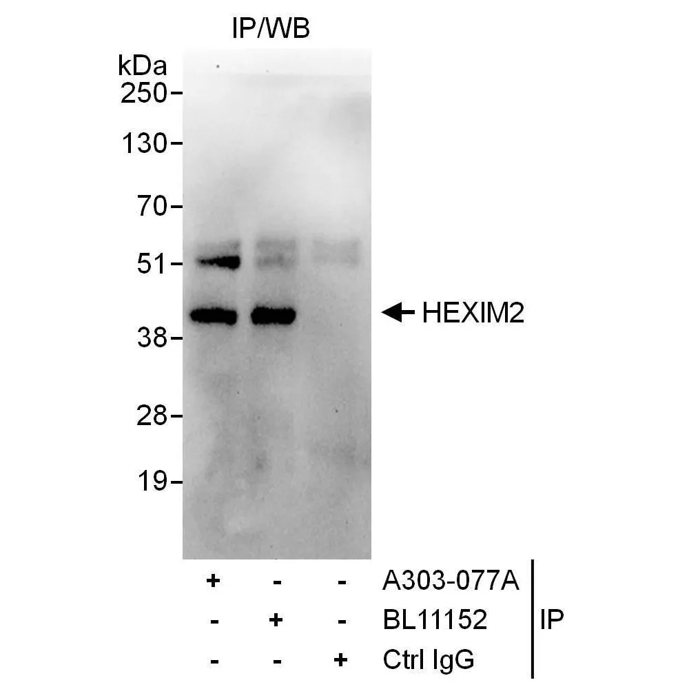 Rabbit anti-HEXIM2 Antibody, Affinity Purified