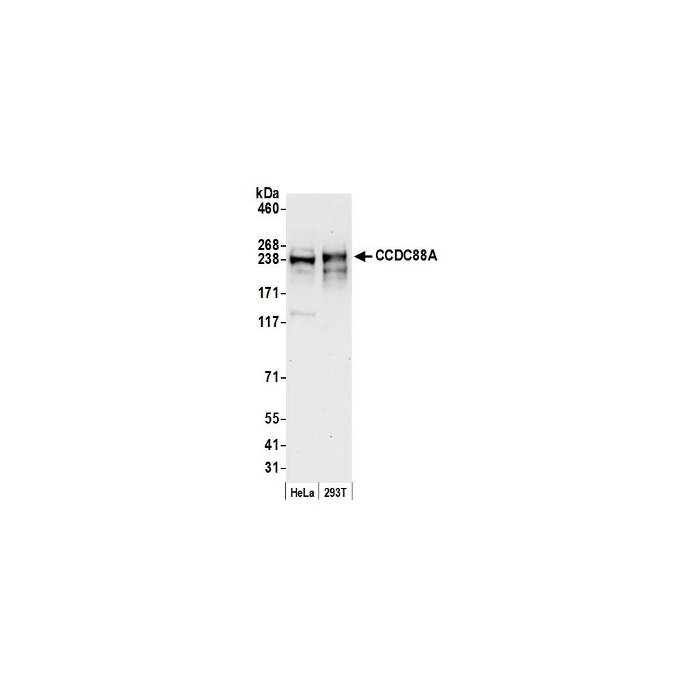 Rabbit anti-CCDC88A Antibody, Affinity Purified