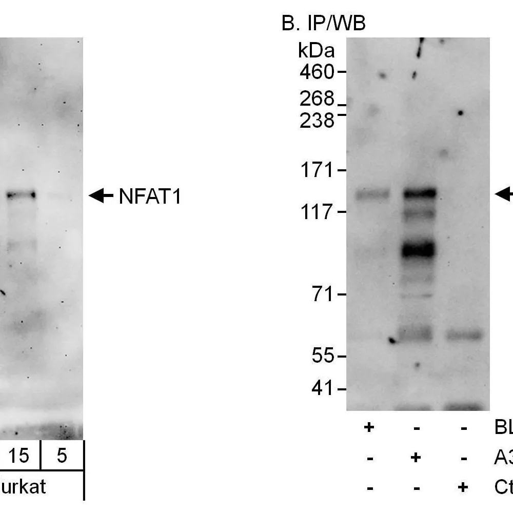 Rabbit anti-NFAT1 Antibody, Affinity Purified