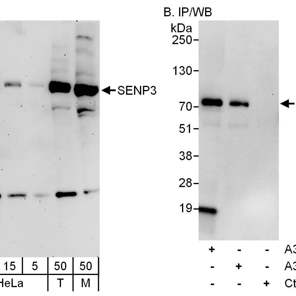 Rabbit anti-SENP3 Antibody, Affinity Purified