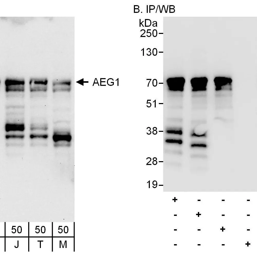 Rabbit anti-AEG1 Antibody, Affinity Purified