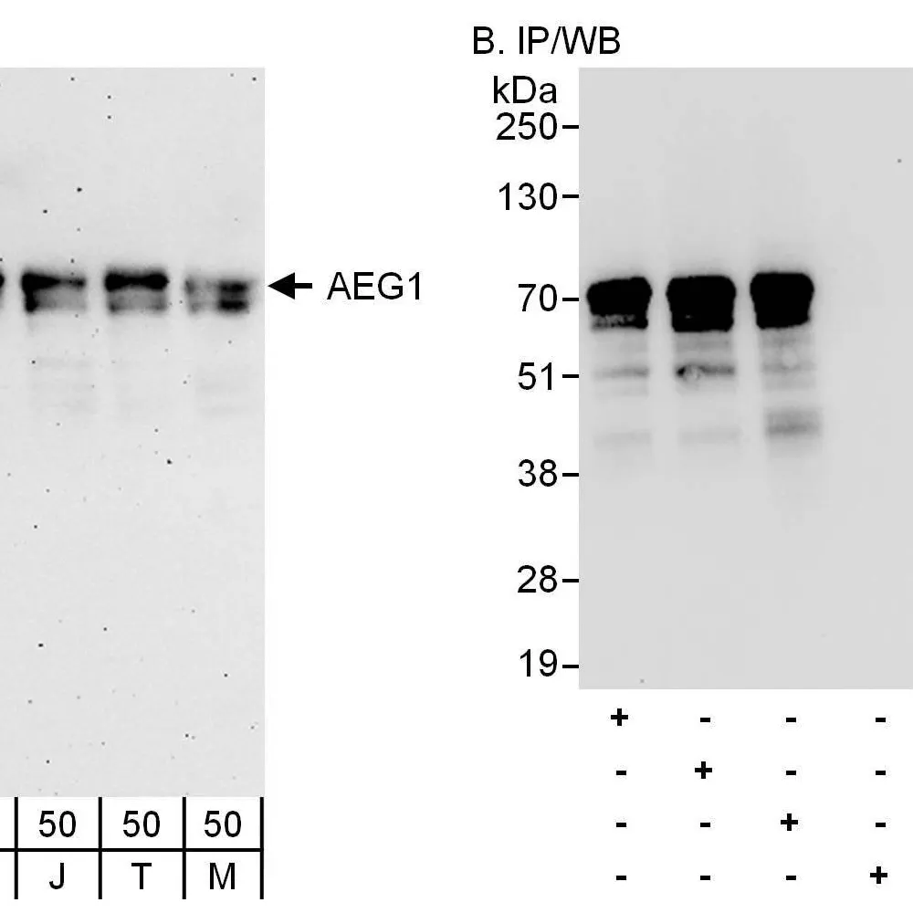 Rabbit anti-AEG1 Antibody, Affinity Purified