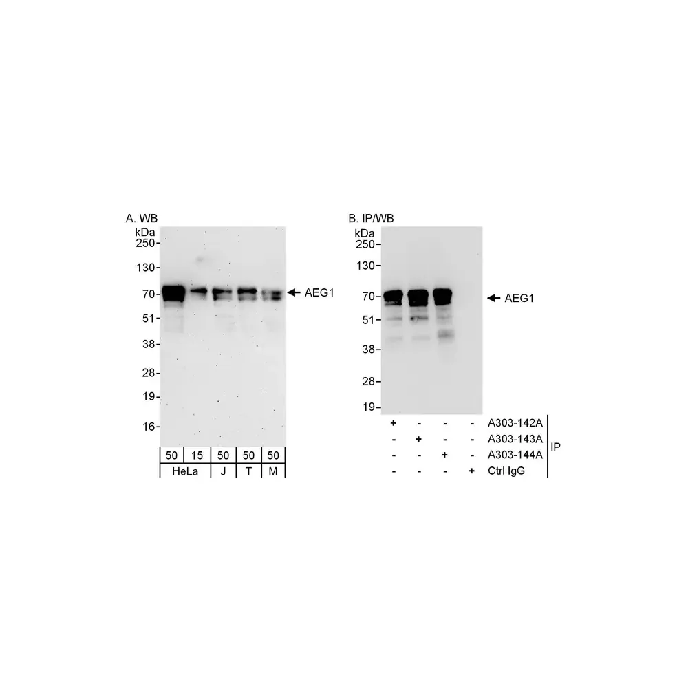 Rabbit anti-AEG1 Antibody, Affinity Purified