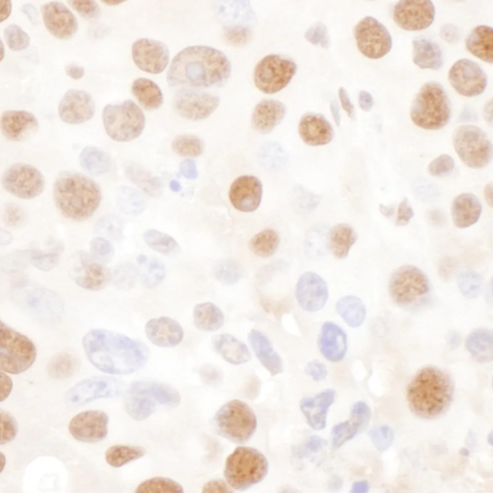 Rabbit anti-NF45 Antibody, Affinity Purified