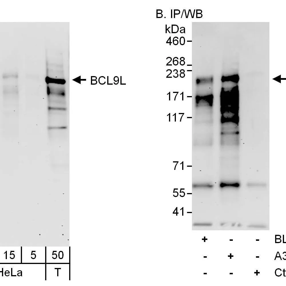 Rabbit anti-BCL9L Antibody, Affinity Purified