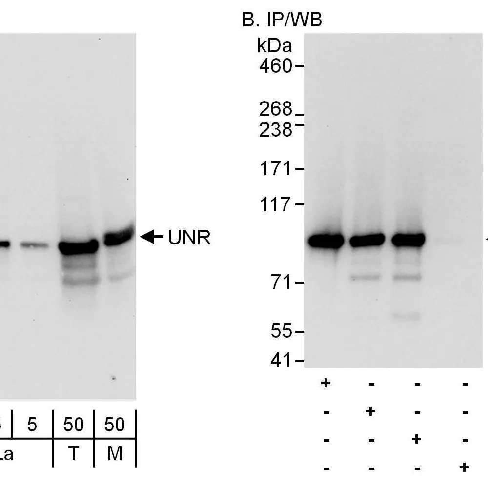 Rabbit anti-UNR Antibody, Affinity Purified