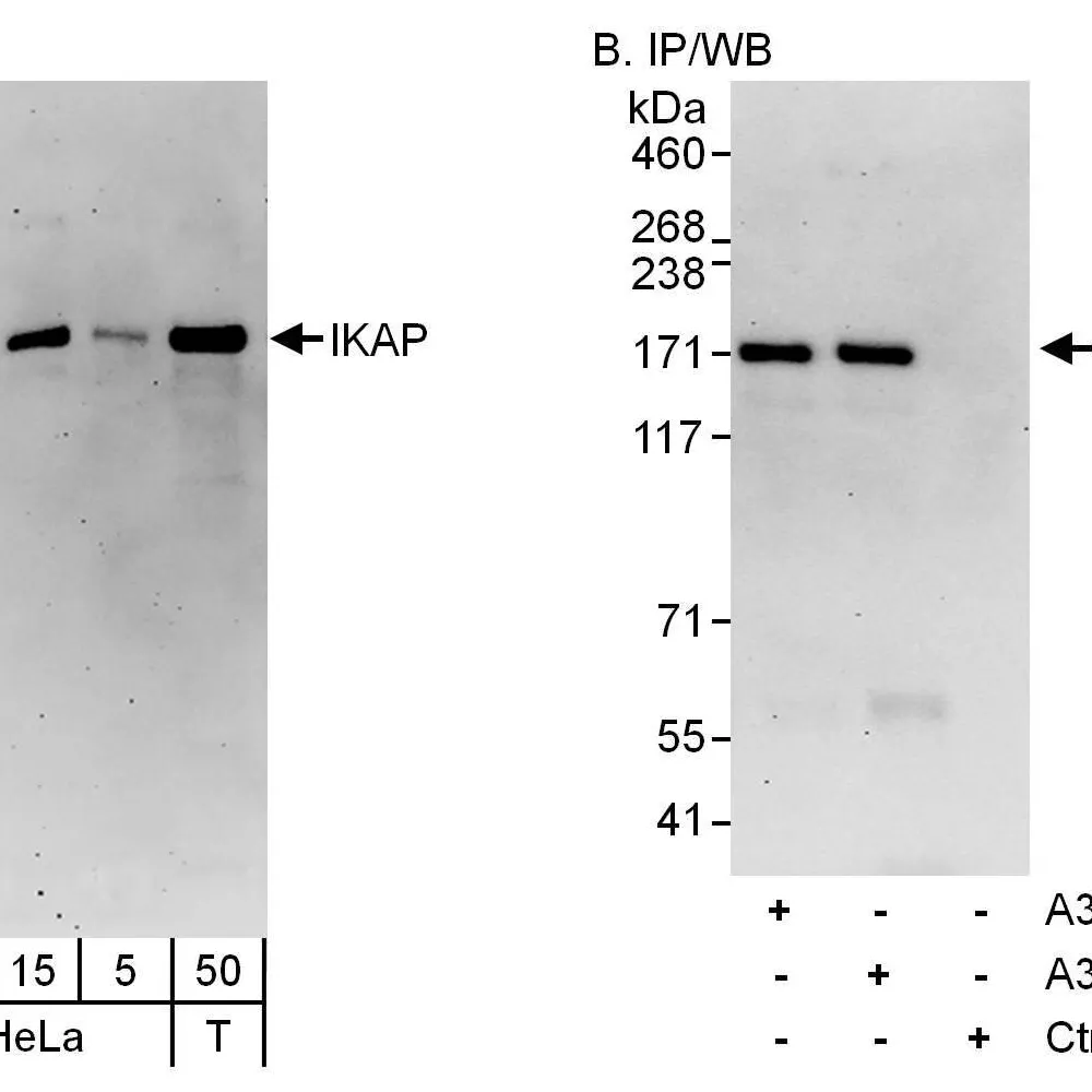 Rabbit anti-IKAP Antibody, Affinity Purified