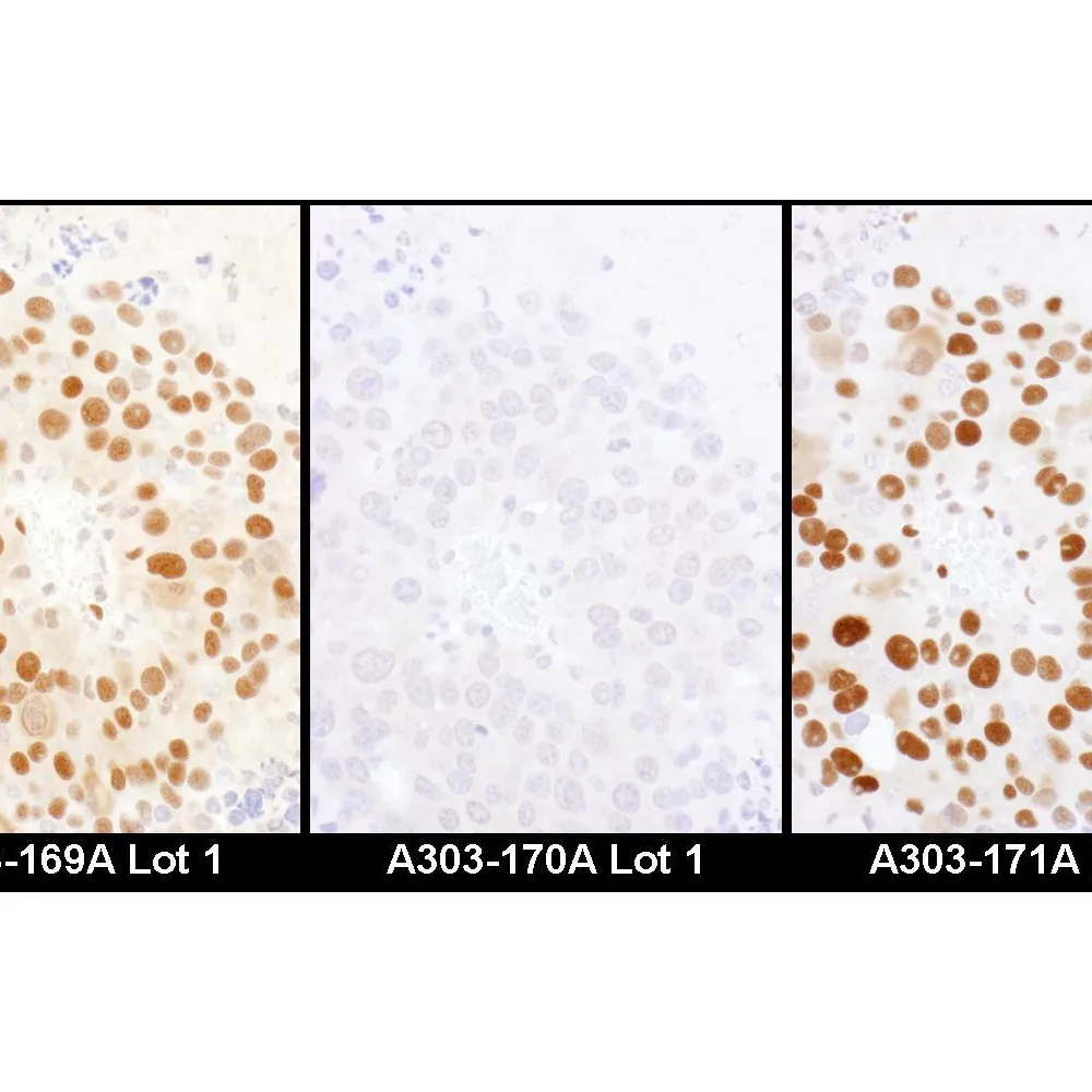 Rabbit anti-HDGF Antibody, Affinity Purified