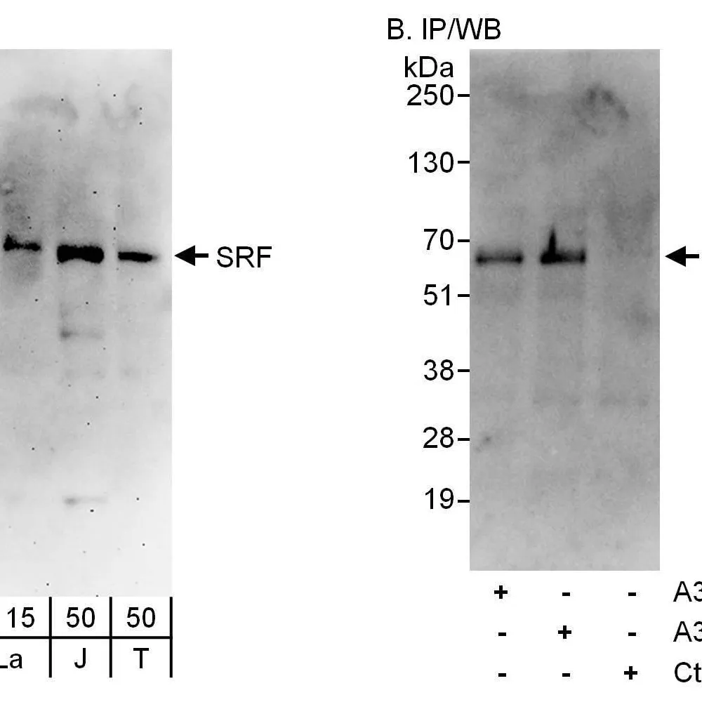 Rabbit anti-SRF Antibody, Affinity Purified