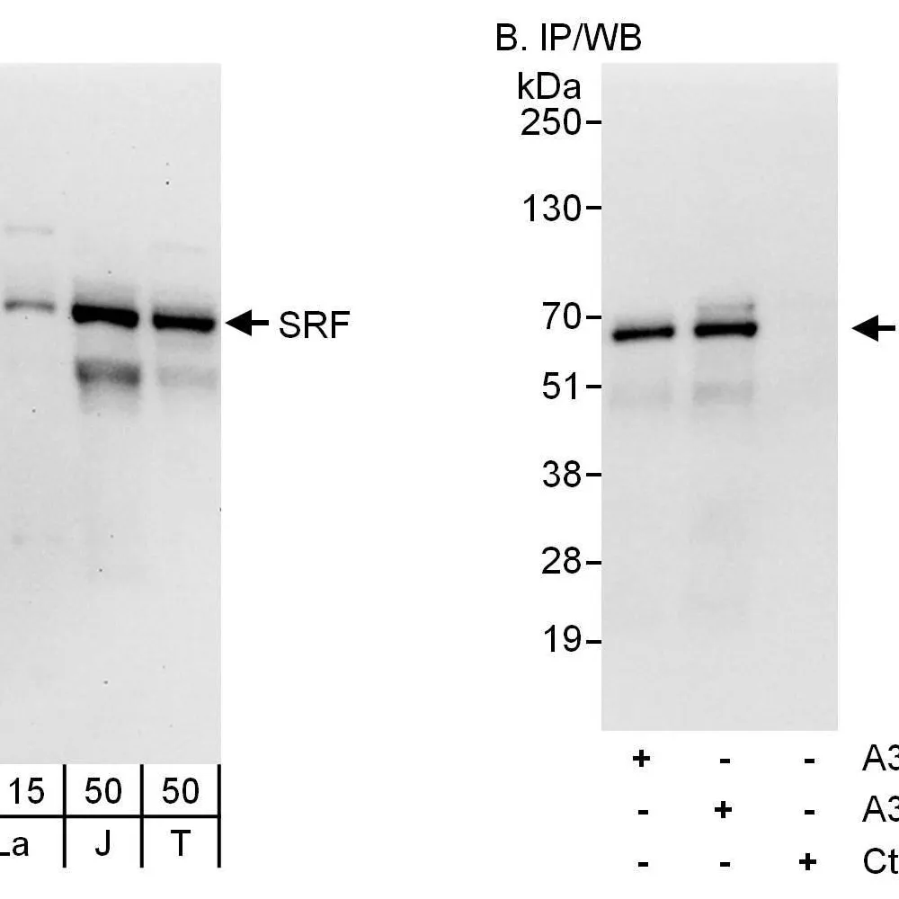 Rabbit anti-SRF Antibody, Affinity Purified