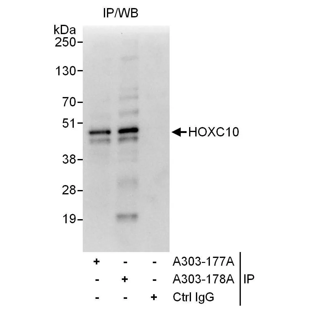 Rabbit anti-HOXC10 Antibody, Affinity Purified