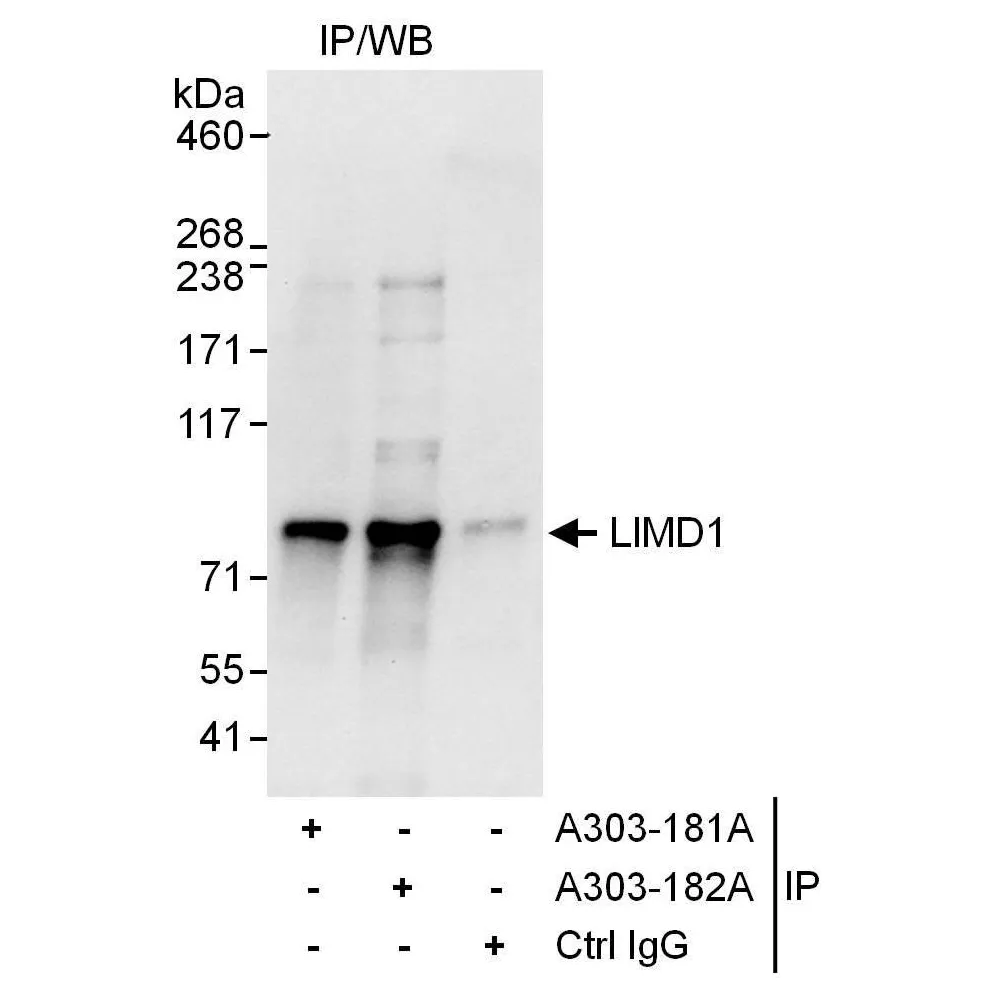 Rabbit anti-LIMD1 Antibody, Affinity Purified