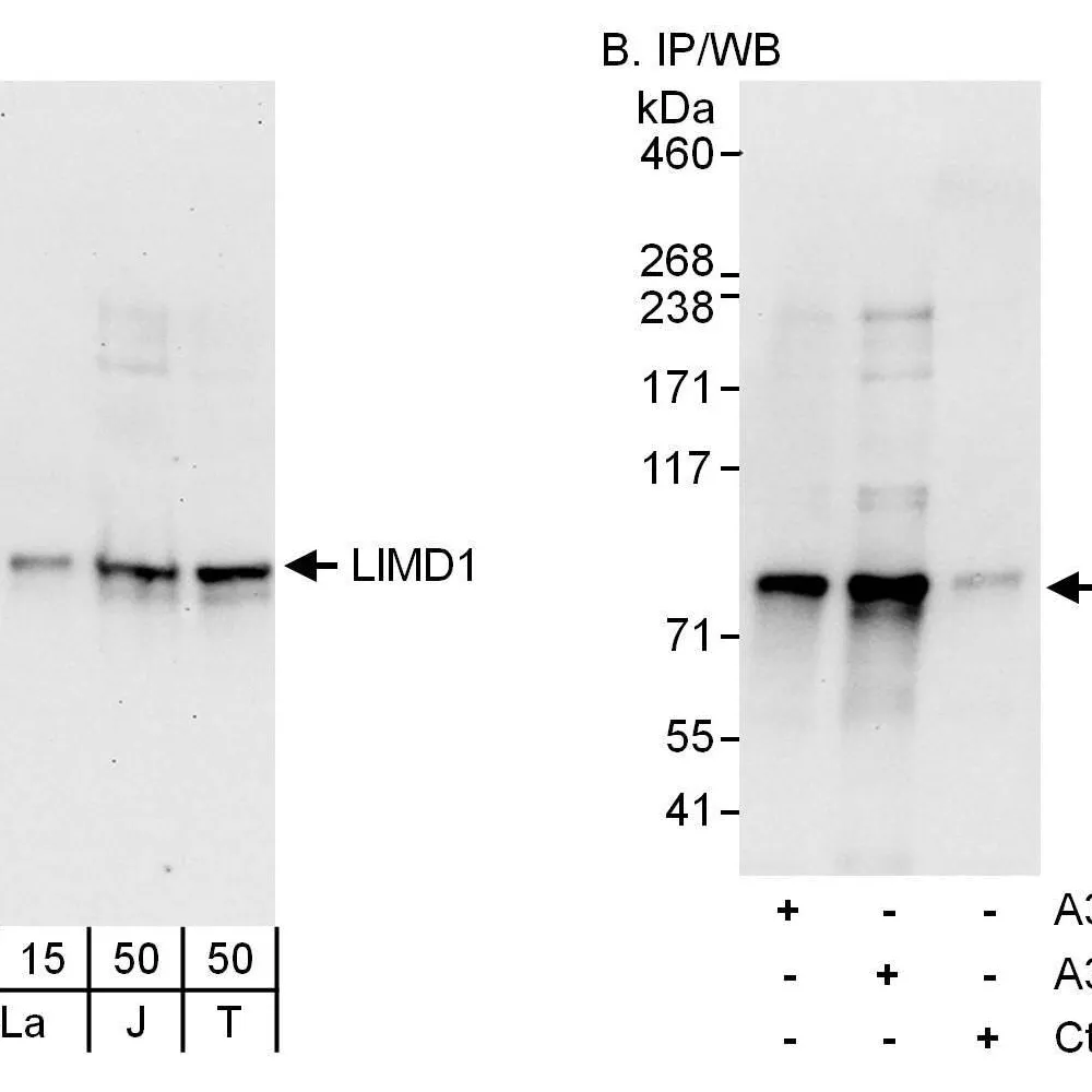 Rabbit anti-LIMD1 Antibody, Affinity Purified