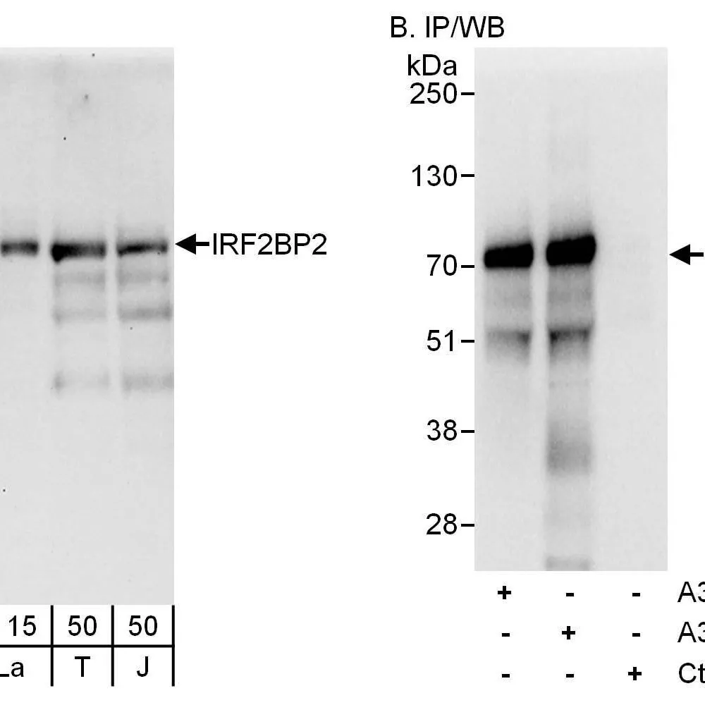 Rabbit anti-IRF2BP2 Antibody, Affinity Purified