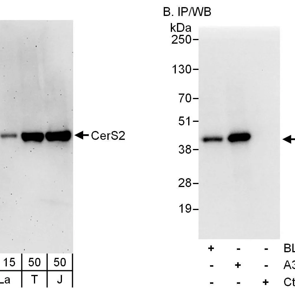 Rabbit anti-CerS2 Antibody, Affinity Purified