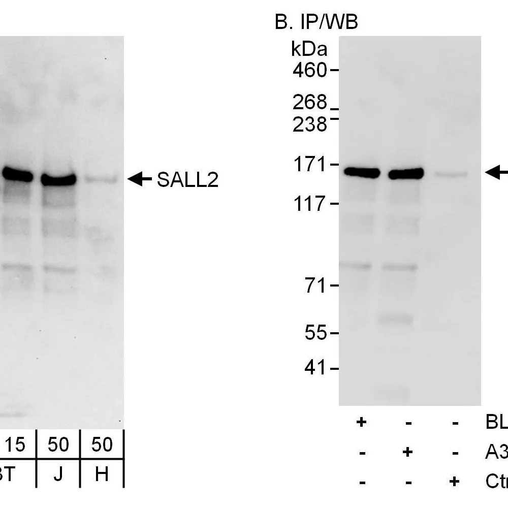 Rabbit anti-SALL2 Antibody, Affinity Purified