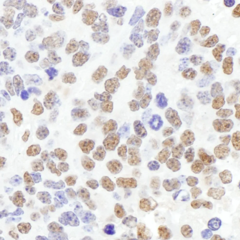 Rabbit anti-SF1 Antibody, Affinity Purified