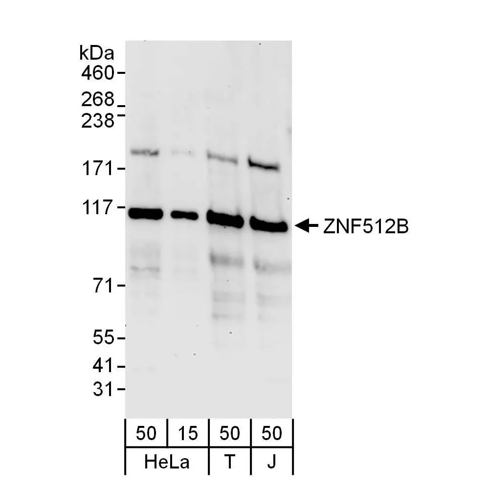 Rabbit anti-ZNF512B Antibody, Affinity Purified